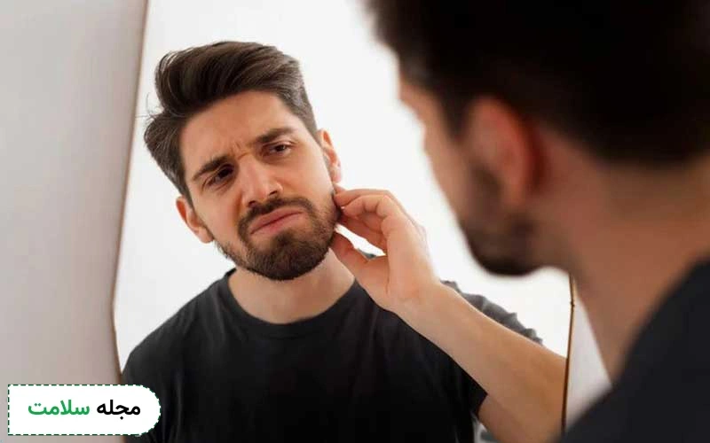 پوسته و شوره ناشی از کاشت ریش و سبیل را چگونه درمان کنیم؟