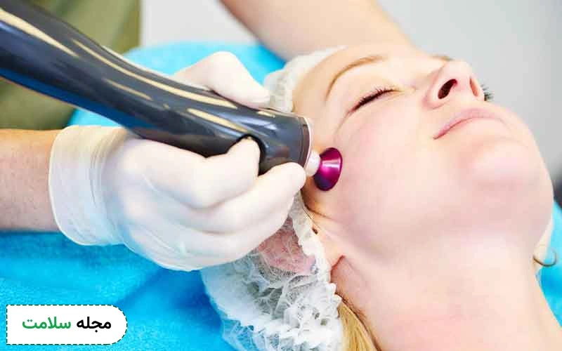 نحوه برداشتن خال با لیزر چگونه است؟
