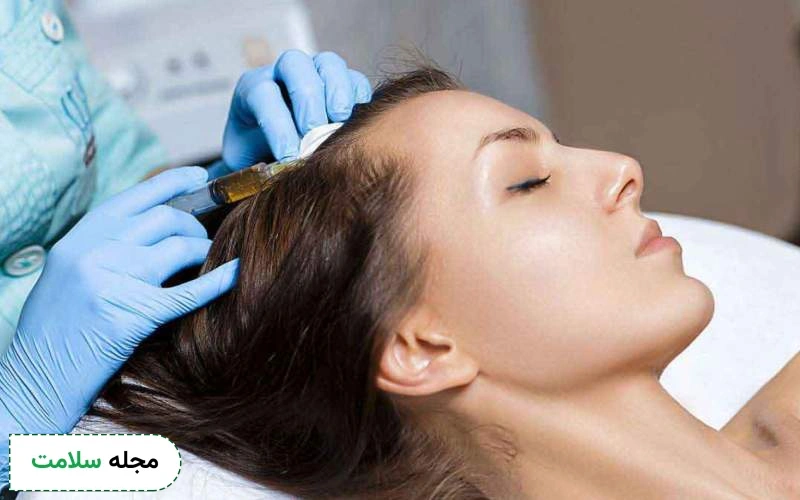 مراقبت های بعد از تزریق فیلر مو چیست؟