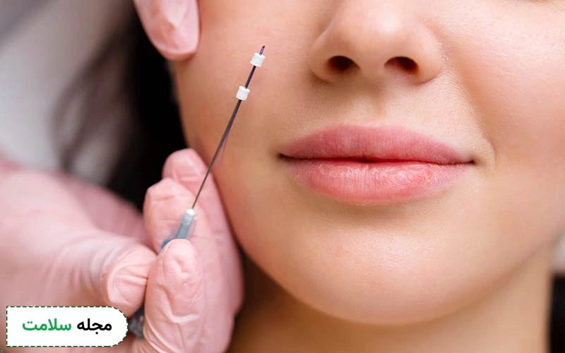 کاربردهای لیفت صورت با نخ و تزریق چربی چه تفاوتی دارند؟