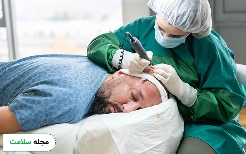 احتمال مرگ در اثر کاشت مو چقدر است؟