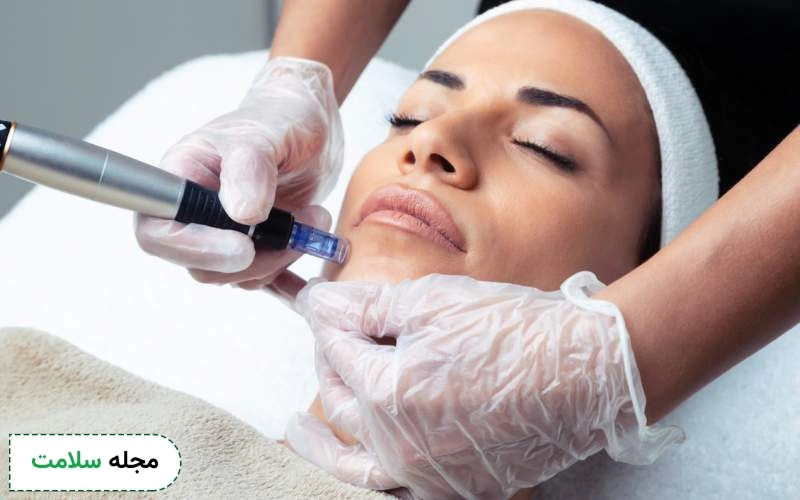 بررسی کامل تفاوت میکرونیدلینگ و مزونیدلینگ