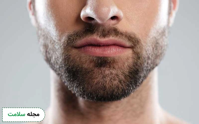 کاشت ریش و سبیل چگونه انجام میشود؟ این روش دائمی است یا موقتی؟