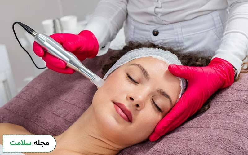 کاربردهای میکرونیدلینگ برای لک صورت چیست؟