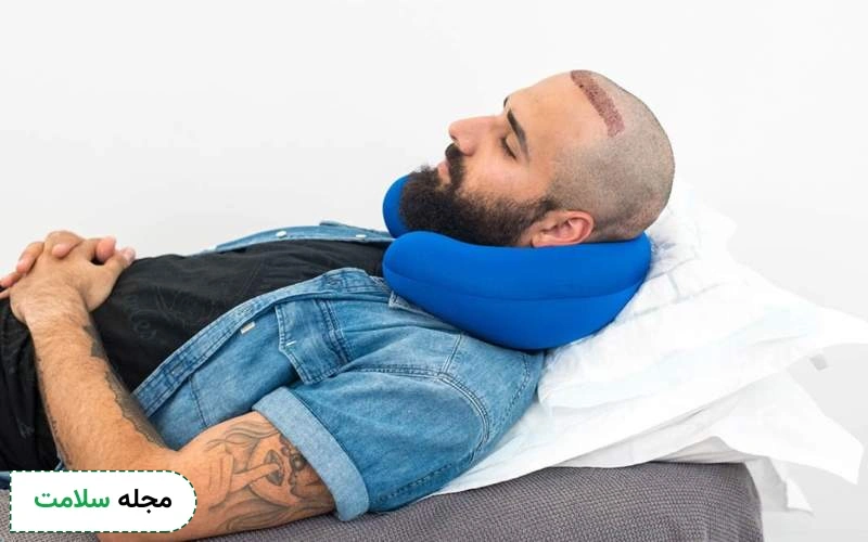 بایدها و نبایدها درباره نحوه خوابیدن بعد از کاشت مو