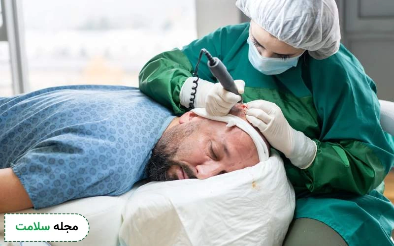 بهترین قرص بعد از کاشت مو چیست؟