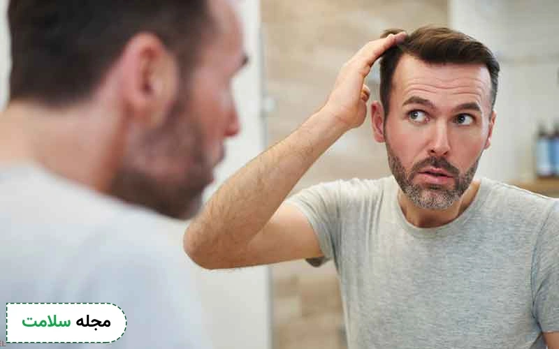 جدیدترین روش کاشت مو چیست؟