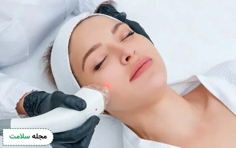 لیزر موهای زائد صورت برای چه افرادی مناسب است؟ آیا لیزر این ناحیه عوارض دارد؟