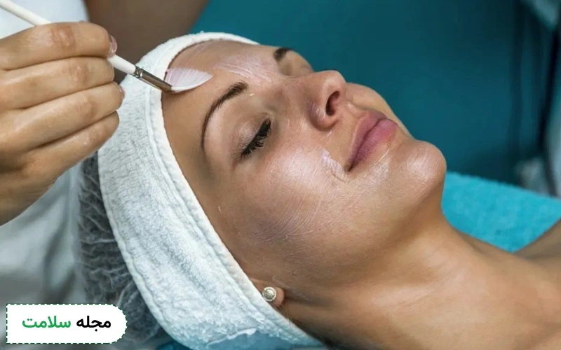 عکس اسید تراپی صورت در فیشال
