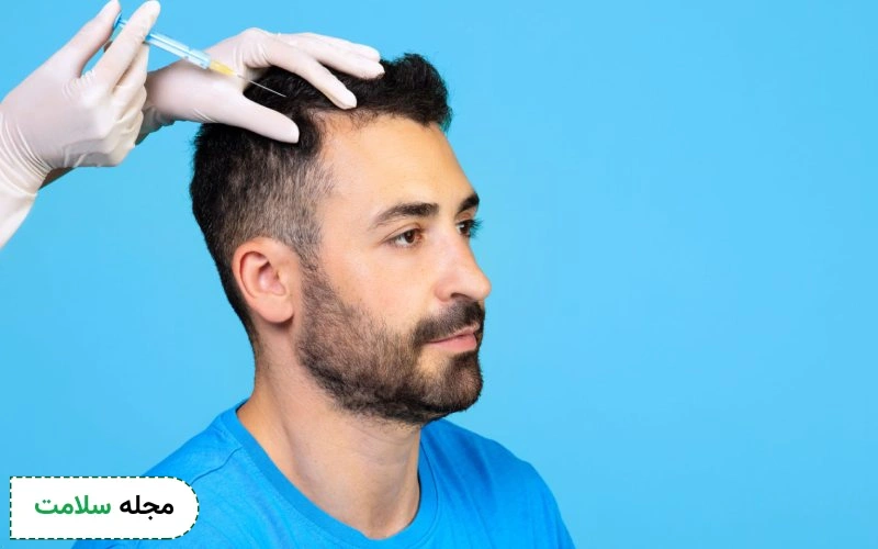 عوارض پی آر پی مو تا چه اندازه جدی است؟