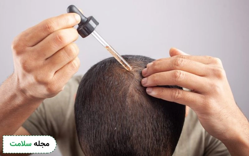 استفاده از داروها و درمان پس از کاشت چه تاثیری دارد؟