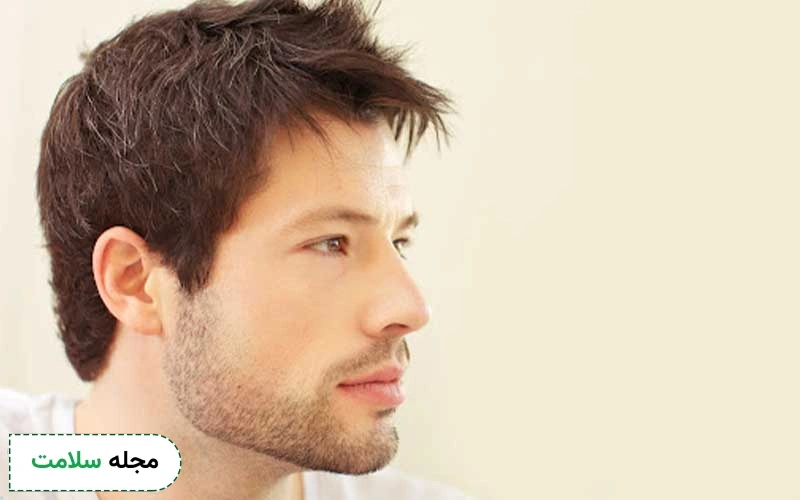 آیا کاشت ریش عوارض دارد؟