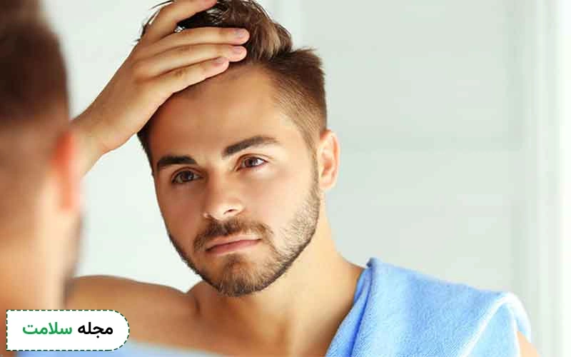 کاشت مو بدون تراشیدن سر چیست؟