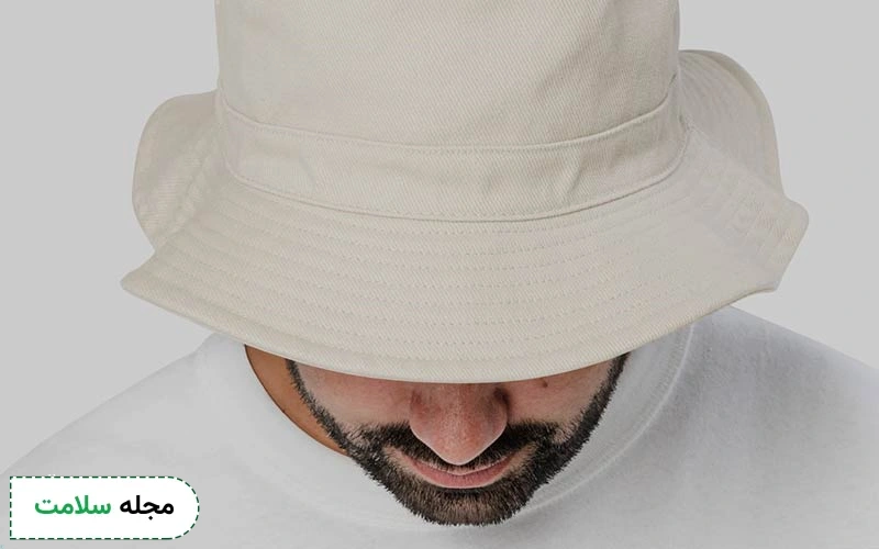 روش محافظت از مو بعد از کاشت در برابر نور آفتاب با کلاه چگونه است؟
