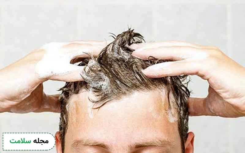 بهترین شامپو بعد از کاشت مو چیست؟