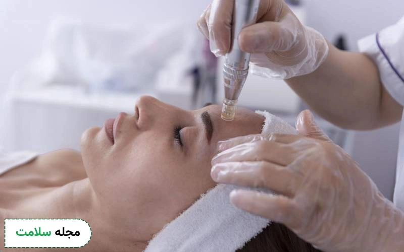 تفاوت نتیجه میکرونیدلینگ و مزونیدلینگ چقدر است؟