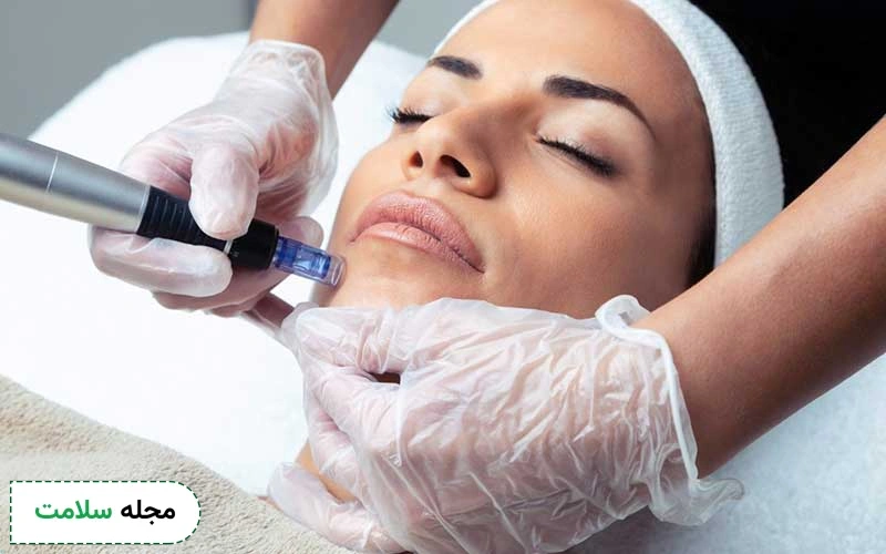 عوارض بلندمدت میکرونیدلینگ چیست؟
