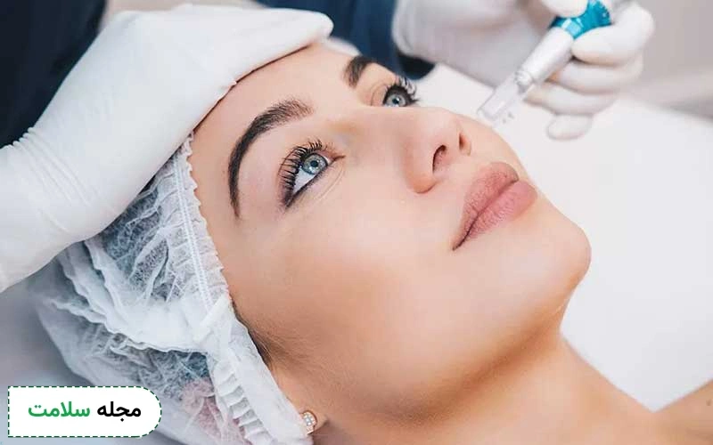 آیا مزونیدلینگ می تواند راهی موثر برای بهبود وضعیت پوستی باشد؟