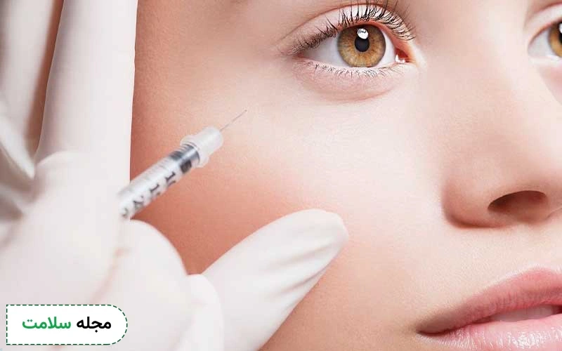 بوتاکس دور چشم چیست؟ چه فواید و عوارضی دارد؟
