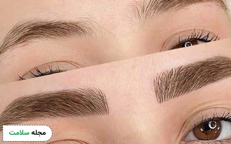 تصویری از تفاوت میکروبلیدینگ و میکروپیگمنتیشن