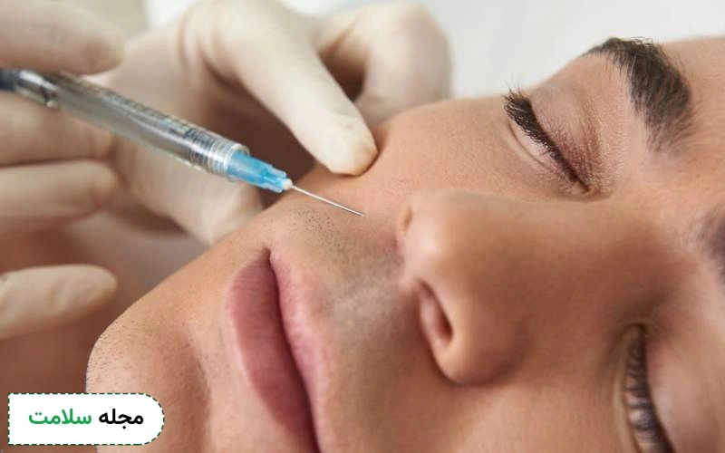 تزریق ژل خط خنده برای چه افرادی مناسب است؟ مزایا و عوارض آن چیست؟