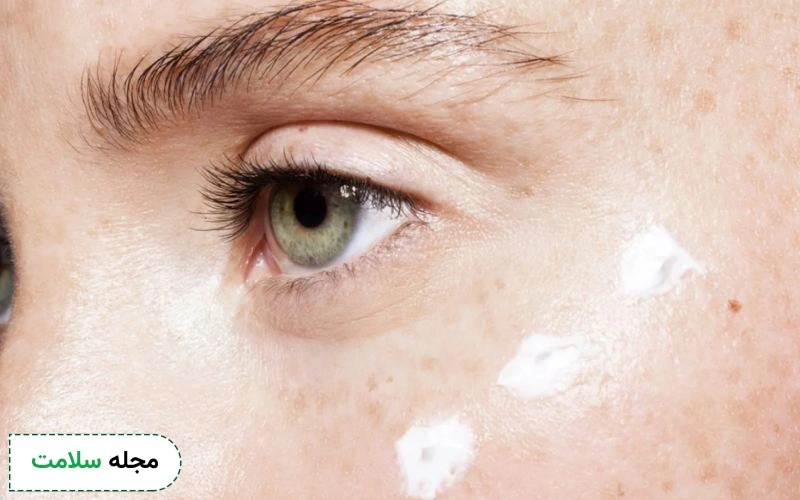 کرم دور چشم چه مزایا و عوارضی دارد؟ کدام نوع آن برای شما مناسب است؟