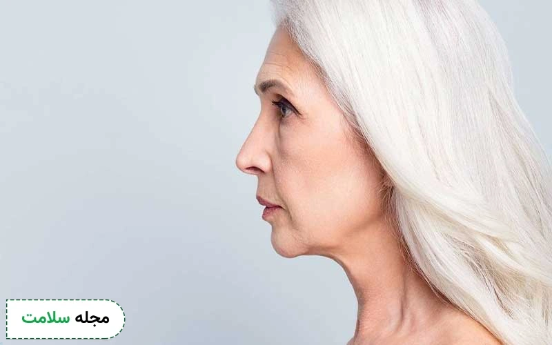 بوتاکس گردن چیست؟ آیا روش موثری برای رفع پیری و چین و چروک این ناحیه است؟