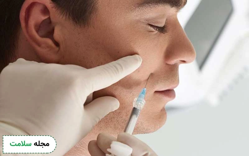 بوتاکس خط خنده چه کاربردی دارد؟ مزایا، عوارض و نکات مراقبتی آن چیست؟