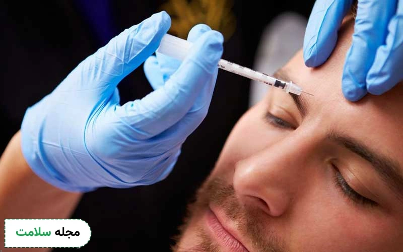 بوتاکس ابروها به لیفت ابرو کمک میکند.