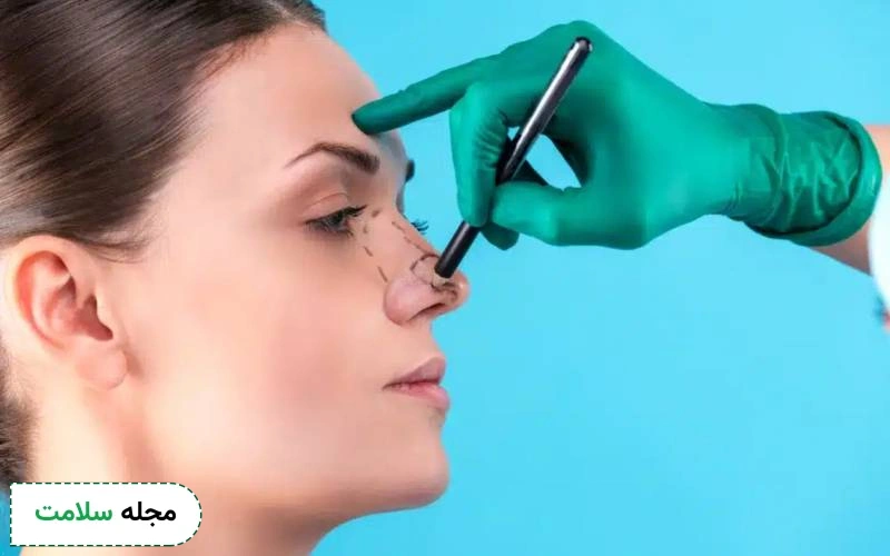 عکس بوتاکس بینی را مشاهده می کنید.