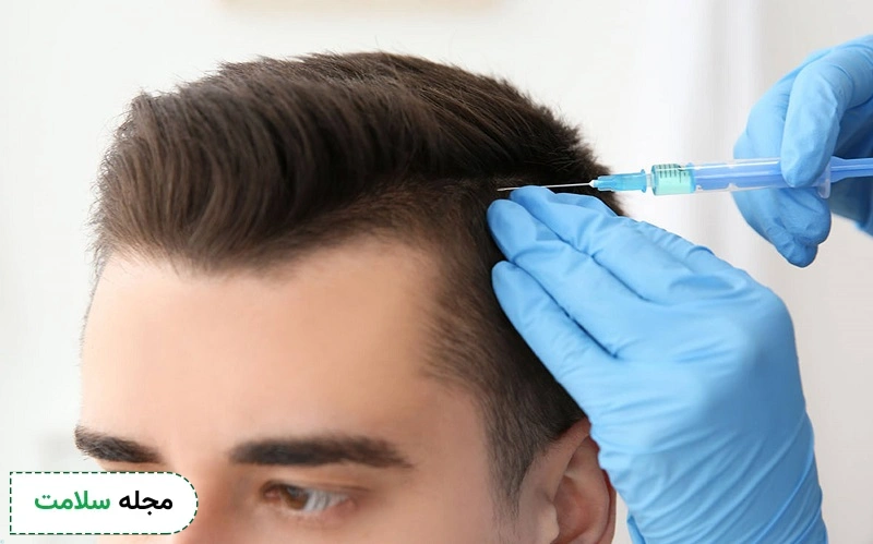 ماندگاری مزوتراپی مو چقدر است و چگونه میتوان دوام مزو مو را افزایش داد؟