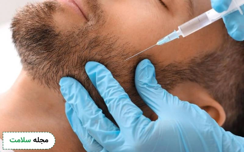 مزوتراپی ریش چگونه انجام میشود؟ مزایا، عوارض و نکات مراقبتی آن چگونه است؟