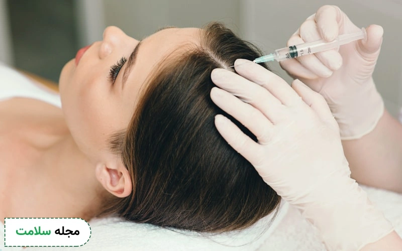 جلوگیری و توقف ریزش مو با مزوتراپی مو ممکن است.