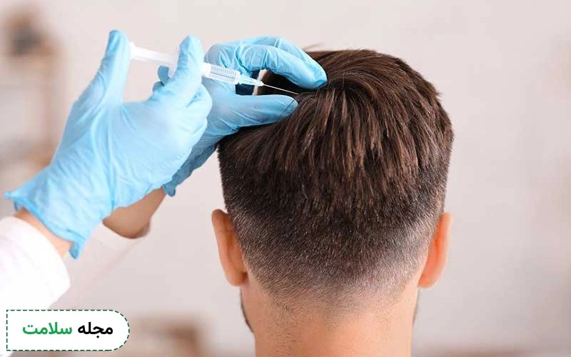 سن مناسب مزوتراپی مو چه سنی است؟ از چه سنی مزو مو را انجام دهیم؟
