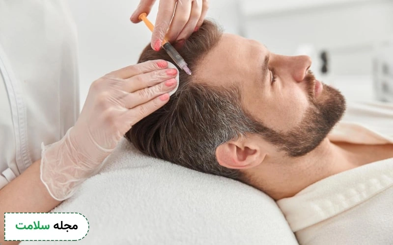 هزینه مزوتراپی مو چقدر است؟