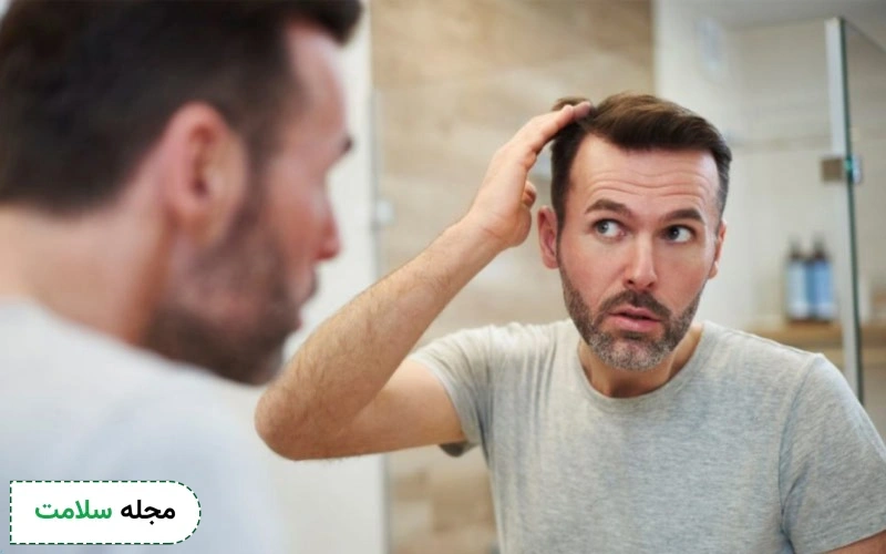 کاشت مو به روش SUT: بررسی مزایا، مراحل و عوارض آن