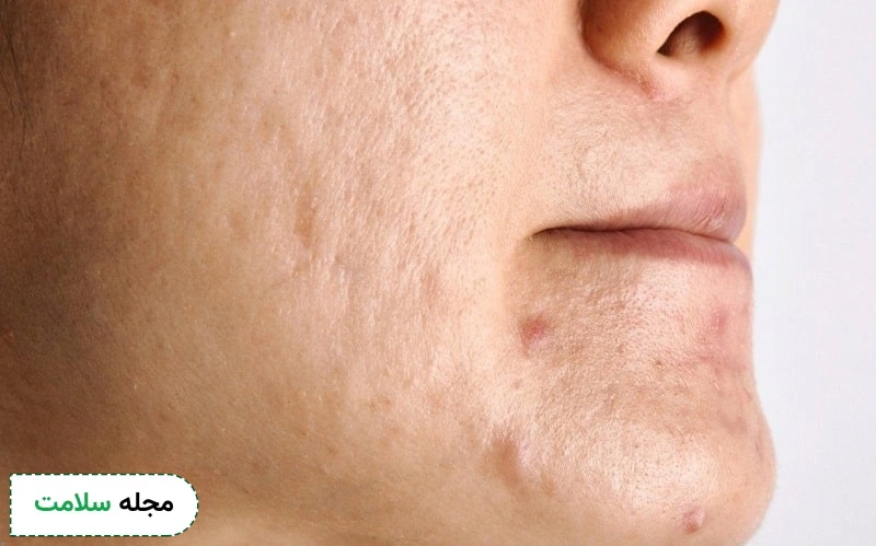 درباره نتایج این روش
