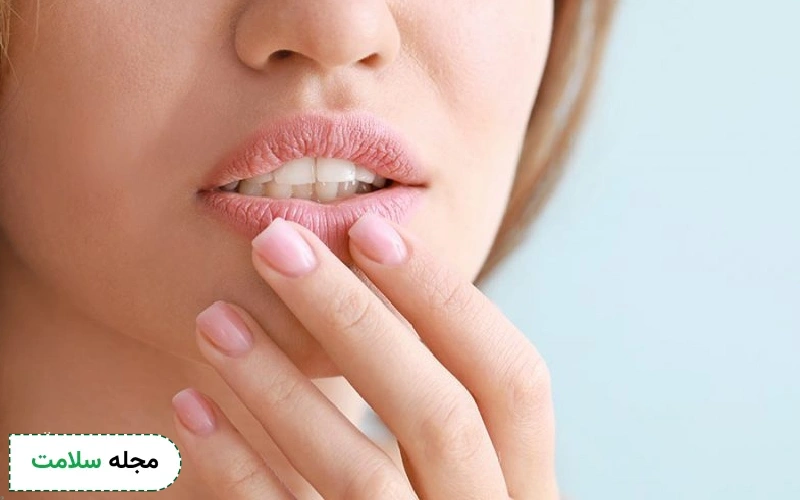 راهکارهای درمان فوری خشکی لب چیست؟ ترک لب را چگونه درمان کنیم؟