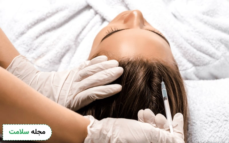 روش انجام مزوتراپی مو چگونه است؟