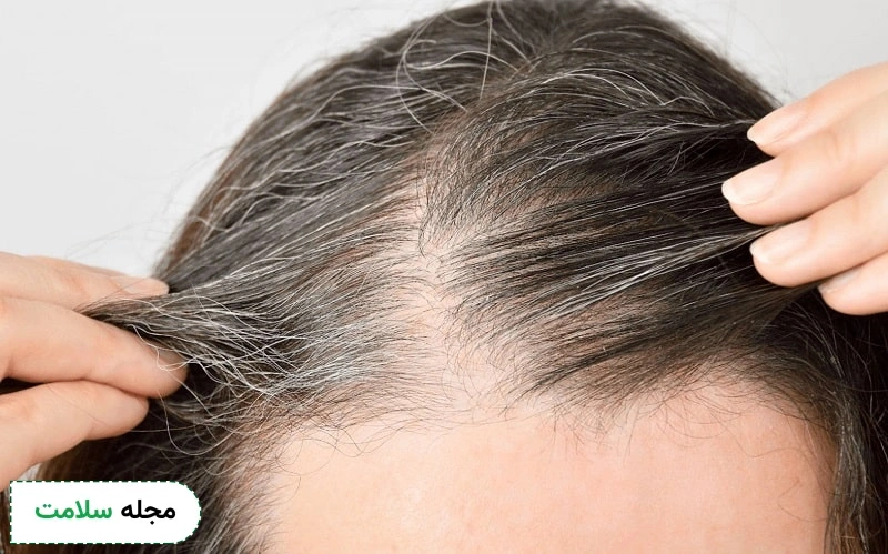 پلاسماتراپی مو چیست؟ کاربرد، عوارض و نکات مراقبتی آن