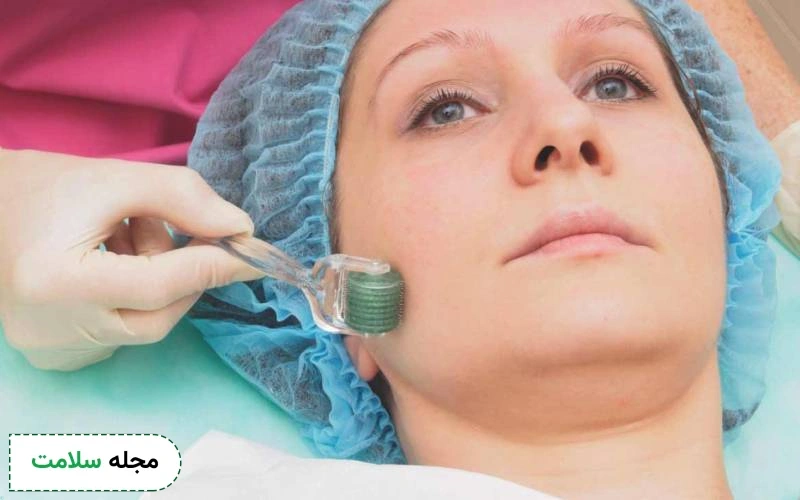 چه کسانی باید از سابسیژن استفاده کنند؟