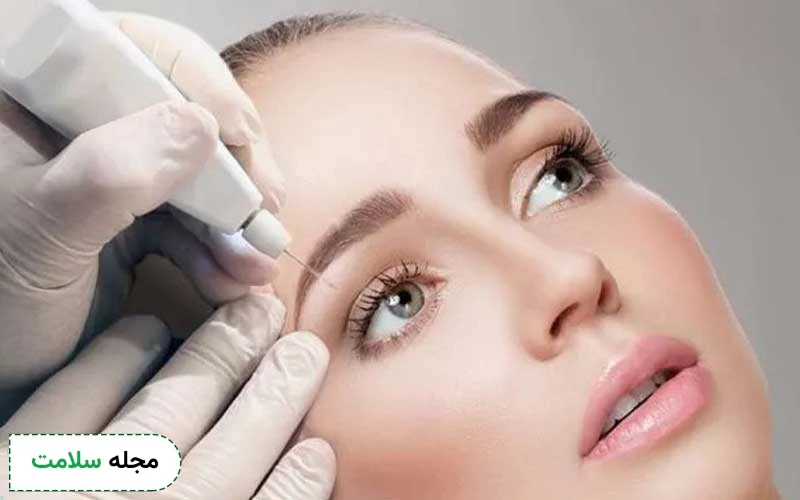 پلاسماتراپی چیست؟ آیا این روش زیبایی و درمانی موثر است؟