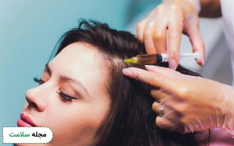مزوتراپی مو چه کاربردی دارد و چگونه انجام میشود؟ مزایا و عوارض مزو مو