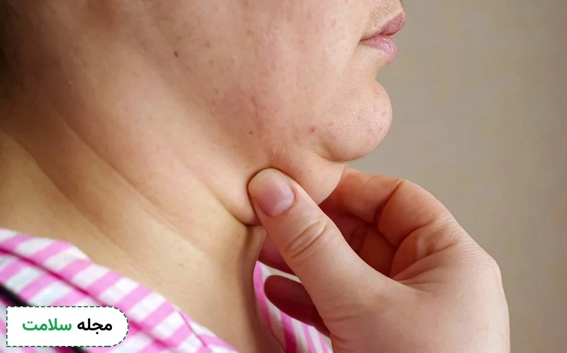 مزوتراپی غبغب چیست و چه کاربردی دارد؟ مزایا، عوارض و نکات مراقبتی آن