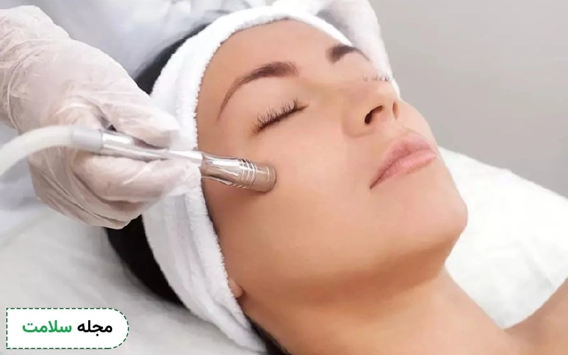 تاثیر میکرودرم ابریژن
