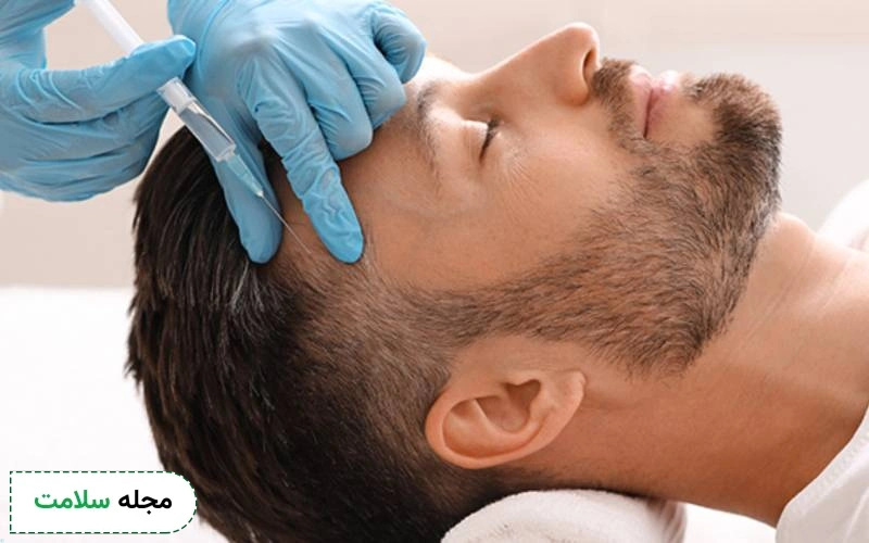 کیا مزوتراپی مو انجام دادن؟