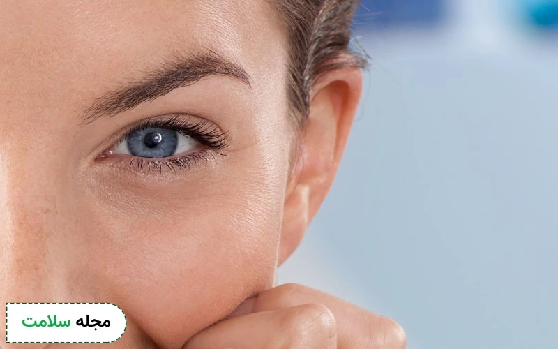 کاربردهای هایفوتراپی دور چشم بهبود پوست این ناحیه است.