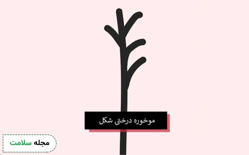 موخوره درختی چیست؟