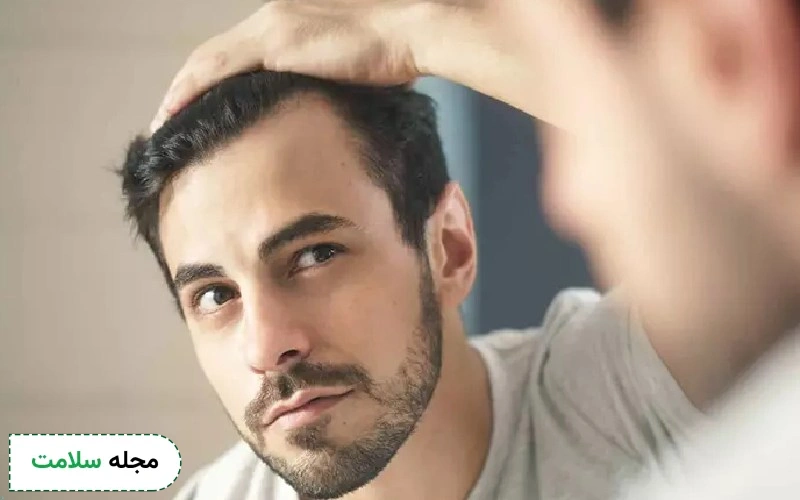 پروتز مو یا کاشت مو؟ آیا پروتز مو بهترین روش برای رفع مشکل طاسی سر است؟