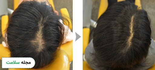 hair-loss-treatments
